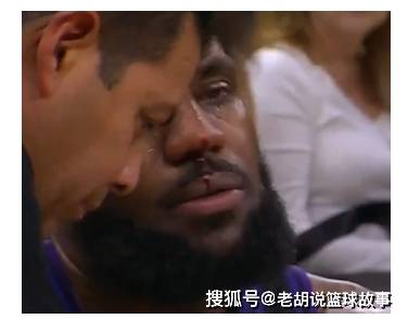 【168NBA】湖人不敌马刺，詹姆斯谈多次被打：我的头很疼，这影响了我的发挥